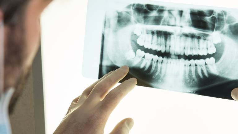 Wisdom Teeth